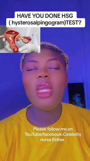 Struggling to Get Pregnant? Discover if Your Fallopian Tubes Are Blocked with HSG Test