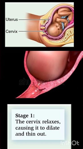 what happened during normal delivery stage -1 of delivery #labourstages #childbirtheducation