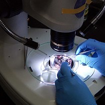 Immunostaining to Visualize Murine Enteric Nervous System Development