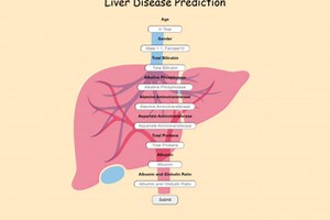 Liver Disease Prediction Project