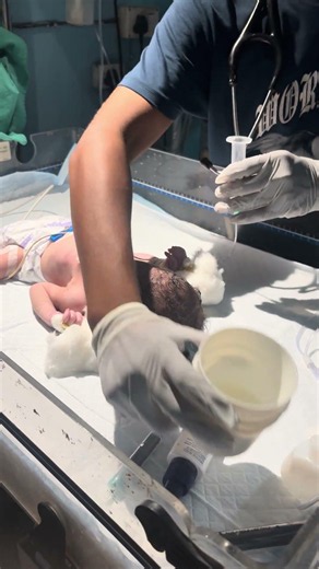 Newborn baby feeding milk🍼🥲👍 #youtubeshorts #nursing #newbornbaby #feeding #milk #beautiful