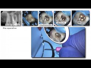 Introduction to Dental Operating Microscope (DOM)