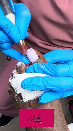 Healthy Nail Treatments: Fix Nails That Don't Grow | Jada Nail Clinic
