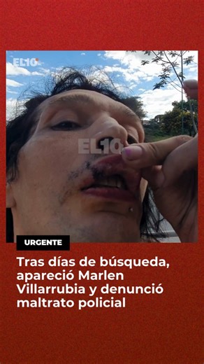 El 10 TV on Instagram: "⚠️ APARECIÓ MARLEN "LA GRILLO" VILLARRUBIA: DENUNCIA MALTRATOS POLICIALES ⚖️ Marlen Alejandra Emilce Villarrubia, mujer trans que era buscada tras perderse su rastro luego de un procedimiento policial realizado el 7 de enero, se presentó en los estudios de El10TV y denunció abusos y maltratos sufridos en una Comisaría Segunda de Salta. Su aparición se da luego de habeas corpus presentados por la Defensoría Pública, el Comité Provincial para la Prevención de la Tortura y o