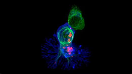 Cerebrospinal Troubles RIFE Healing Frequency