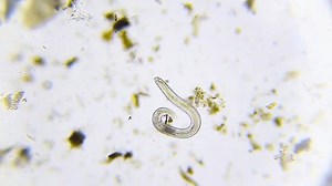 Slow-moving Nematode Under 100x Brightfield Microscopy Stock Footage Video (100% Royalty-free) 3998533661 | Shutterstock
