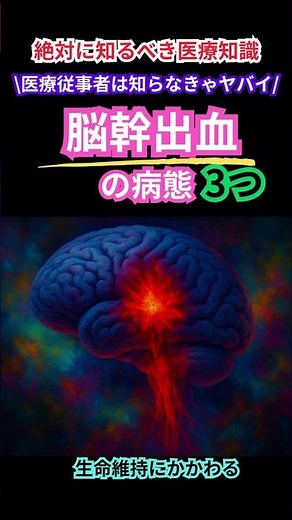 🧠生命維持にかかわる⚠️脳幹出血の病態３つ🔥#医療従事者 #脳幹出血 #脳出血 #脳血管障害 #看護師 #医者 #医療従事者 #介護#予防医療 #予防