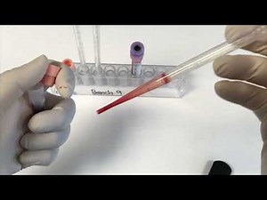 [ENG SUB] Erythrocyte sedimentation rate