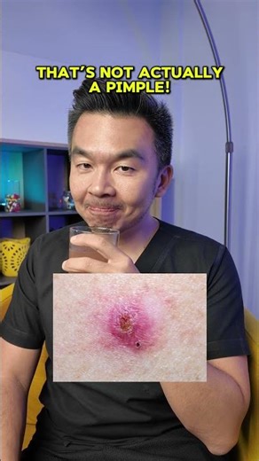 Why that spot might not be a pimple