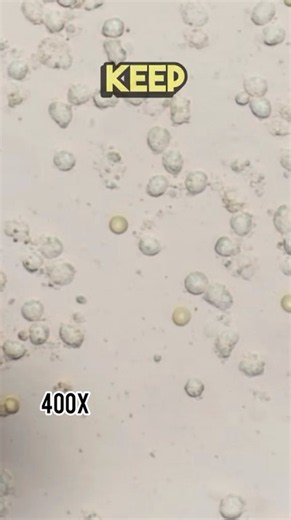 What pimple pus really looks like under a microscope