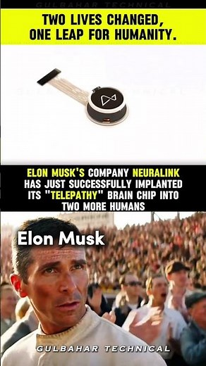 Elon Musk’s Neuralink Changed 2 Lives Forever