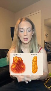 39K views · 1.1K reactions | Not all fat is the same.  Let’s break...