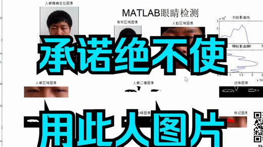 MATLAB眼睛检测。可二次拓展为眼睛，嘴巴结合的疲劳检测