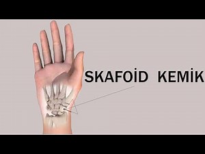 Skafoid Kemik Kırıkları