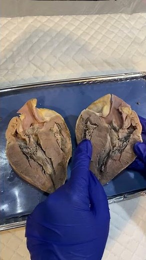 BIO 169 Sheep Heart Dissection