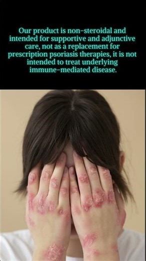 #Edimakor Psoriasis 1