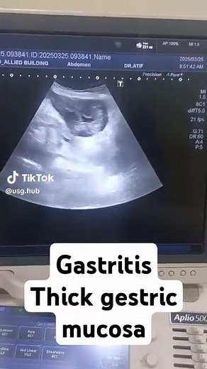 Book Your Ultrasound Appointment Today
