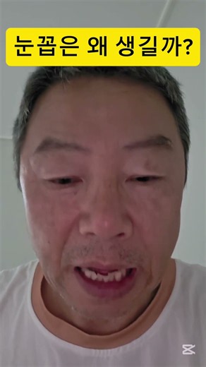​눈꼽 색깔만 봐도 알 수 있는 내 눈 건강 상태