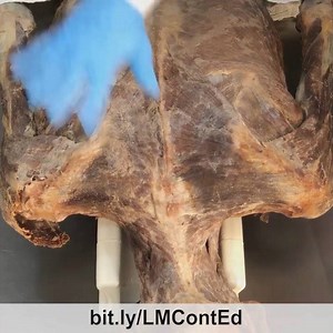 11K views · 155 reactions | TRAPEZIUS (“TRAP”)  . This video clip...