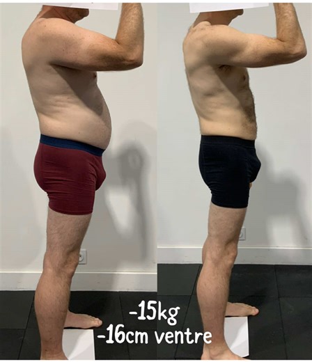 –15 kg. –16 cm de tour de ventre. Et surtout… une nouvelle énergie. Après 40 ans, on entend souvent : “C’est trop tard.” “Le métabolisme est mort.” “À cet âge-là, on ne change plus.” C’est faux. Ce n’est pas une question d’âge. C’est une question de cadre, de discipline et de constance. Cette transformation, ce n’est pas juste une perte de poids. C’est un homme qui a repris le contrôle de son corps, de son mental, et de son quotidien. Parce que l’objectif n’est pas de vivre longtemps à tout prix