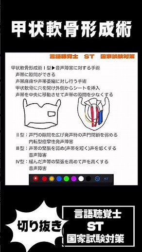 27-112 声帯外転術 気管切開術 甲状軟骨形成術Ⅰ型とⅡ型の違い 声帯内脂肪注入術とは？