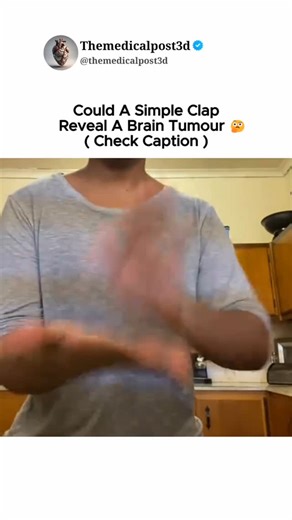 Themedicalpost3d on Instagram: "A simple clap test, also known as the "clap test" or "hand clap test", can sometimes reveal potential issues with brain function or nerve damage, but it's not a definitive diagnostic tool for brain tumors. The test assesses the integrity of the corpus callosum, the part of the brain connecting the two hemispheres. . . . . #medical #clap #braintumour #brain #explore #fyp #viral #instadaily #instagood"