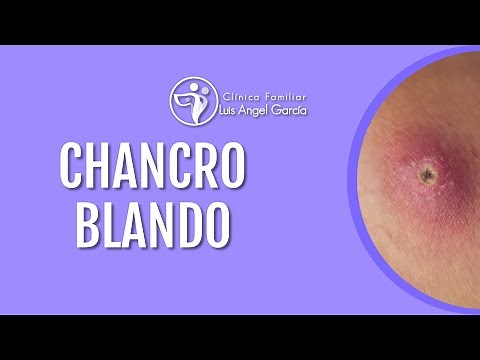 Chancro blando | Información importante