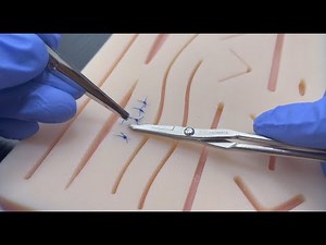 How to remove stitches (for patients)