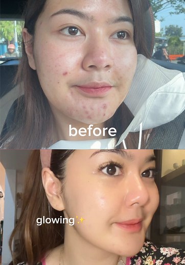 Top Recommended Moisturizers for Glowing Skin