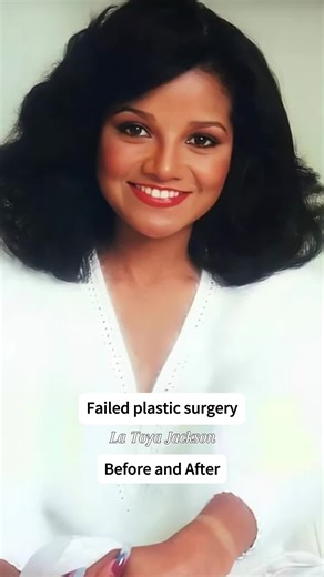 Celebrities with Failed Plastic Surgery: Shocking Transformations