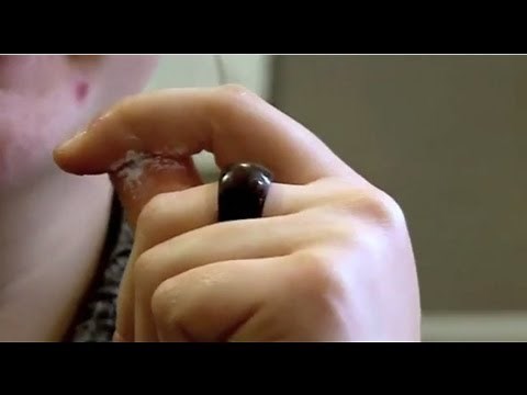 Fingertips Glued Together (Part 1) - Bizarre ER
