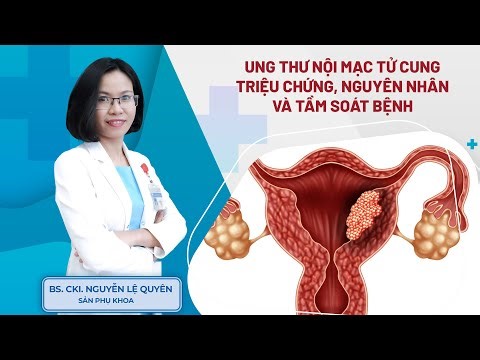 Ung thư nội mạc tử cung: Bệnh ung thư phụ khoa phổ biến ở phụ nữ, khám ngay nếu có triệu chứng này