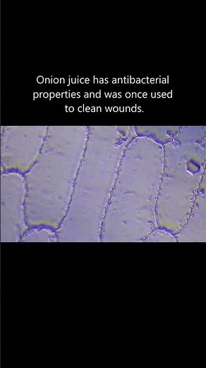 What Onion Looks Like Under a Microscope 🧅 | Nature’s Perfect Pattern #microscopy #biology #science