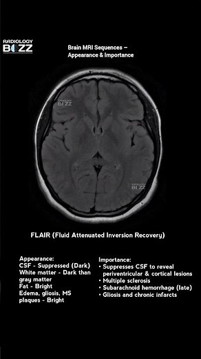 Brain MRI Sequences Explained | Radiology Essentials #radiologybuzz #anatomy #medicalimaging