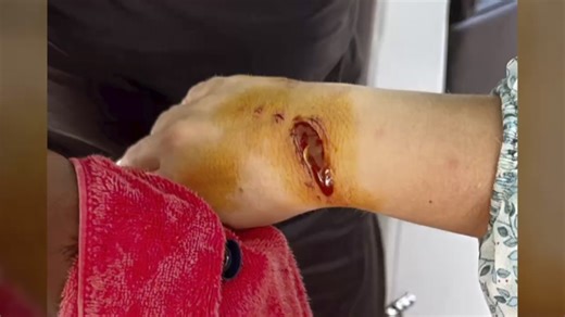 Moment swimmer is mauled by SHARK as she filmed snorkelling Maldives trip