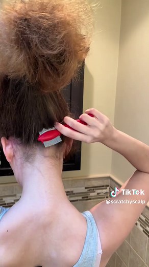 Effective Scalp Psoriasis Plaque Removal Technique