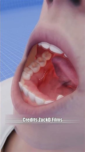 How underbite surgery Works😲#shorts #viral