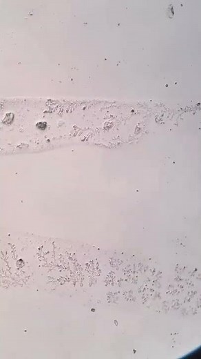 Así se ve una LAGRIMA DE FELICIDAD bajo el MICROSCOPIO 💧🔬 | #SHORT