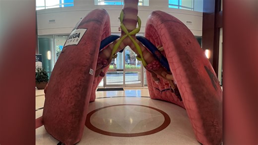 Giant ‘Mega Lung’ turns heads at START Cancer Center to raise awareness