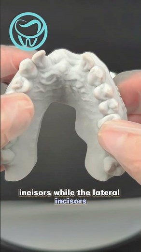 the Valplast Flexible Partial Denture(no clasps). #dentallab #dentist #dentalprosthesis