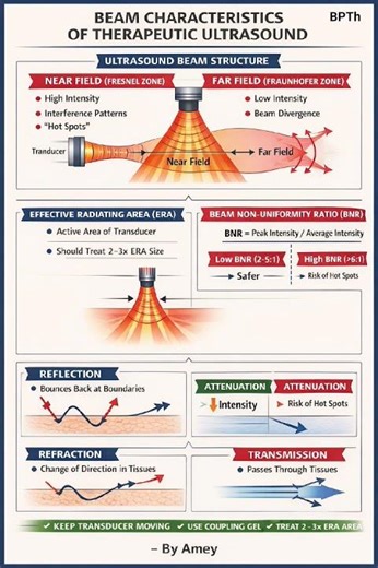 Beam characteristics of therapeutic ultrasound #bpth #physiotherapist #physiotherapy