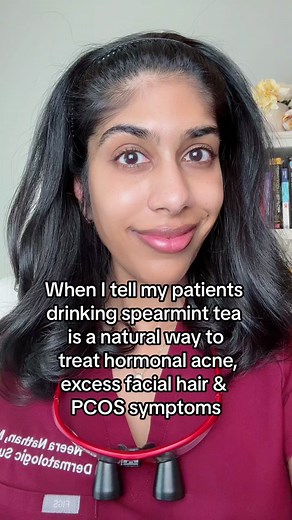 Natural Treatment for Hormonal Acne and Excess Facial Hair | Spearmint Tea