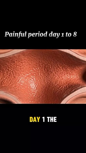 Navigating Painful Periods: Day-to-Day Experiences