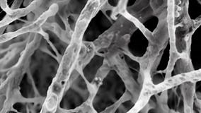Scanning Electron Micrograph of Root Nodules Structures Formed by Nitrogenfixing Bacteria in the Roots of Leguminous Stock Footage - Video of cell, structures: 313050936