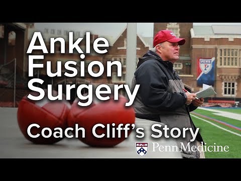 Ankle Fusion Surgery | Cliff's Story