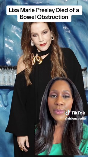 Understanding Bowel Obstruction: Causes, Symptoms, and Treatment