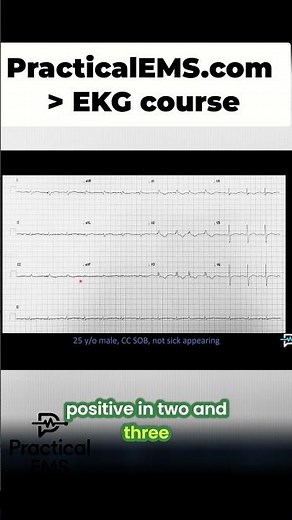 PA Reveals EKG Secrets: Right Axis Deviation and Blocks! #shorts