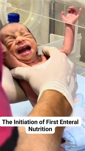 The initiation of the first enteral nutrition for a preterm infant is a crucial step in supporting physiological adaptation and organ growth. Every precisely administered drop of nutrition serves as the foundation for the infant's immune system development and resilience. #NICUcare #NICUbaby #prematurebaby #babycare #cutebaby #neonatalcare #newbornbaby #littleangel | Yuli Ismalia