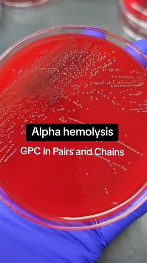Enterococcus faecium