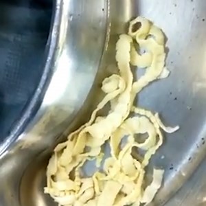 PrepLadder on Instagram: "Tapeworm (cestodes) surgical removal in a patient of intestinal obstruction. #PrepLadder #NEETPGPreparation #NEETPG2022 #Tapeworm #Cestodes #MedicalVideos"